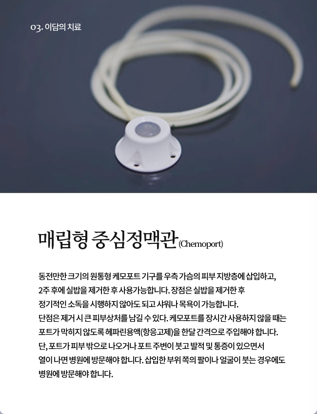 매립형 중심정맥관(Chemoport)