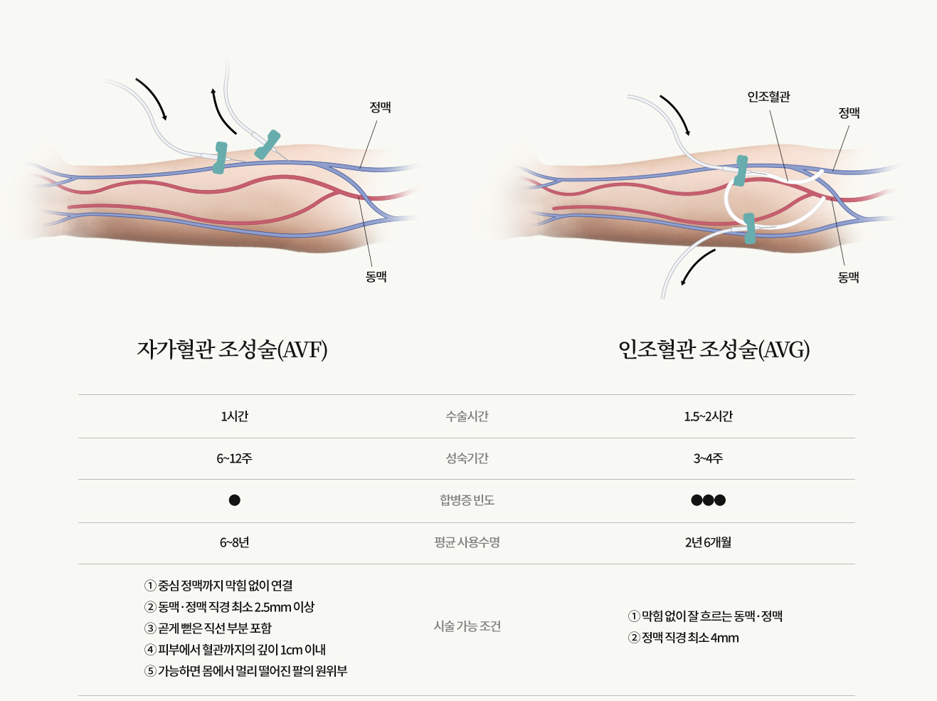 투석혈관의 조성